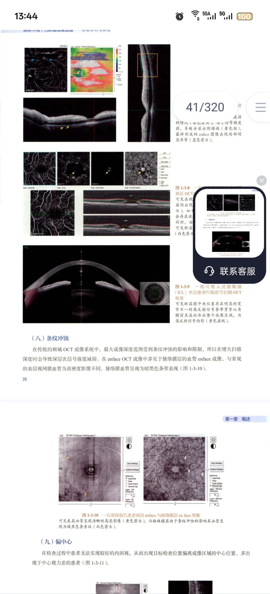 新书推荐：眼前节相干光断层成像图谱