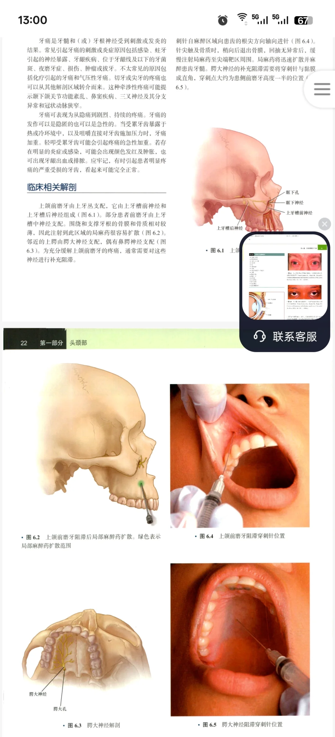 新书推荐：疼痛介入治疗图谱