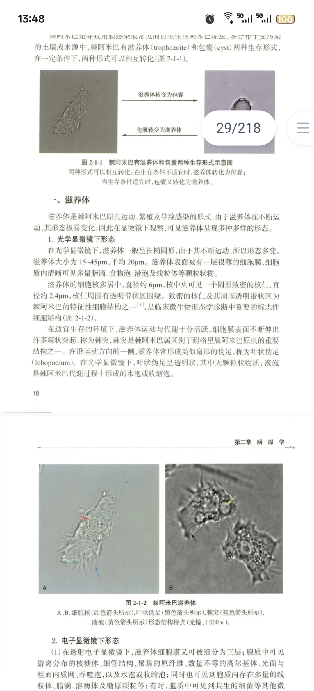 新书推荐：眼表疾病必看：阿米巴角膜炎