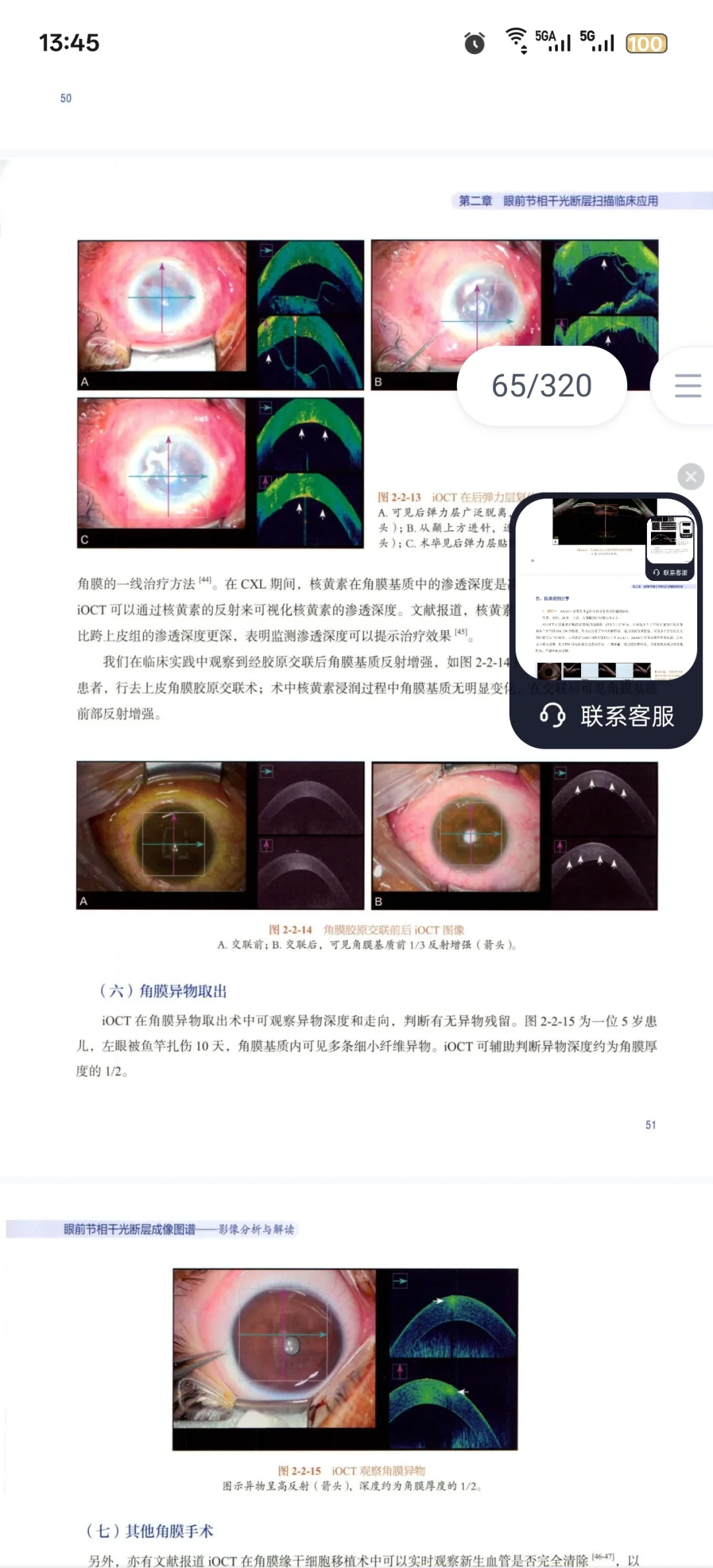 新书推荐：眼前节相干光断层成像图谱
