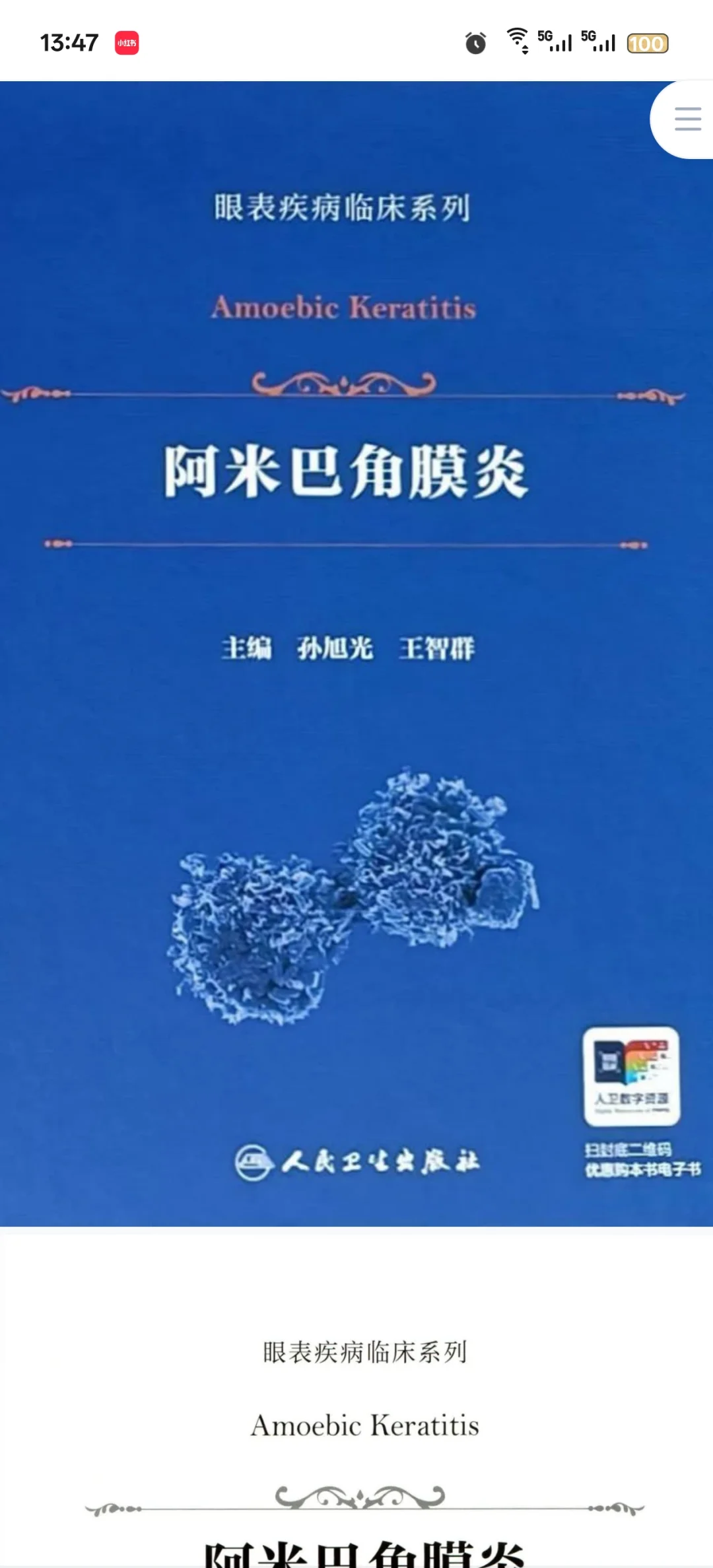 新书推荐：眼表疾病必看：阿米巴角膜炎
