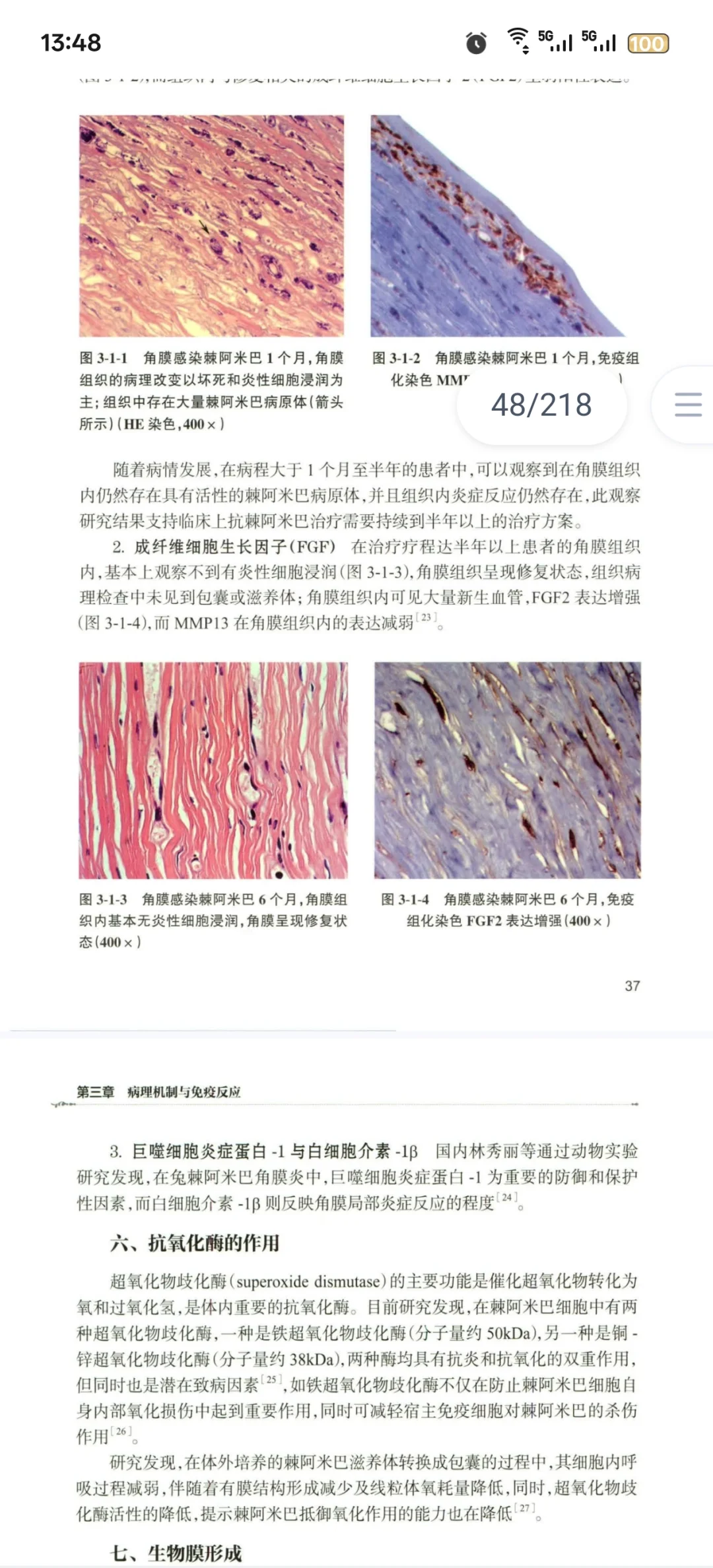 新书推荐：眼表疾病必看：阿米巴角膜炎