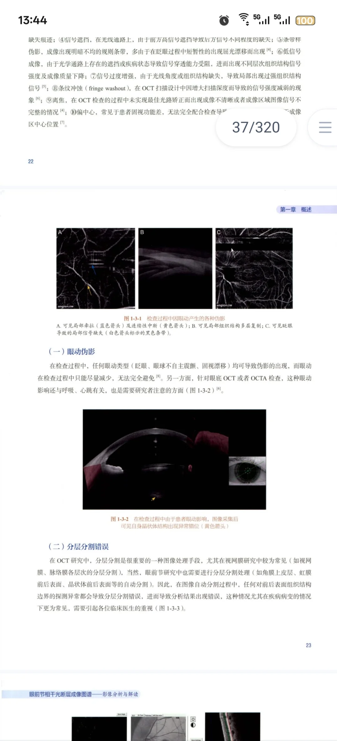 新书推荐：眼前节相干光断层成像图谱