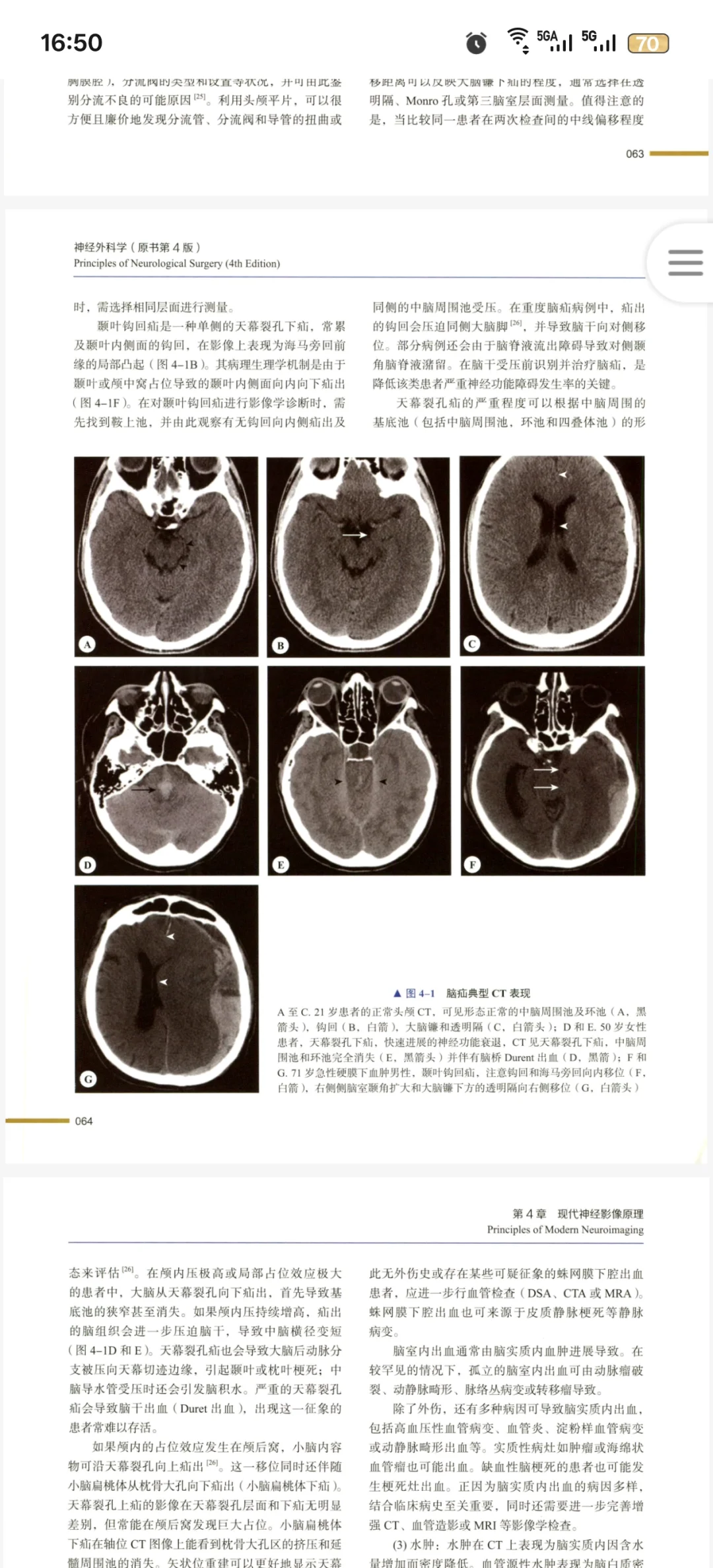 神经外科医生必看新书推荐