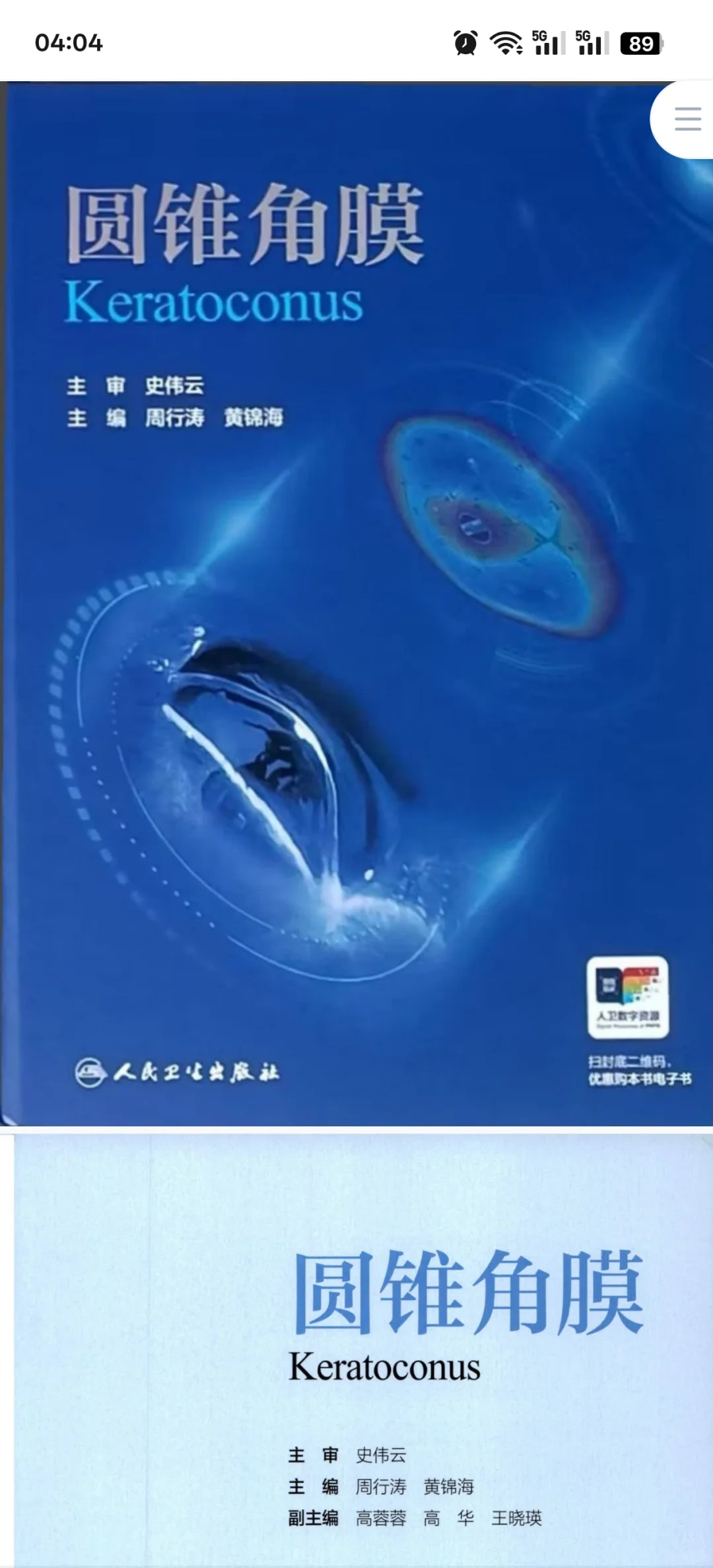 圆锥角膜必看书籍推荐