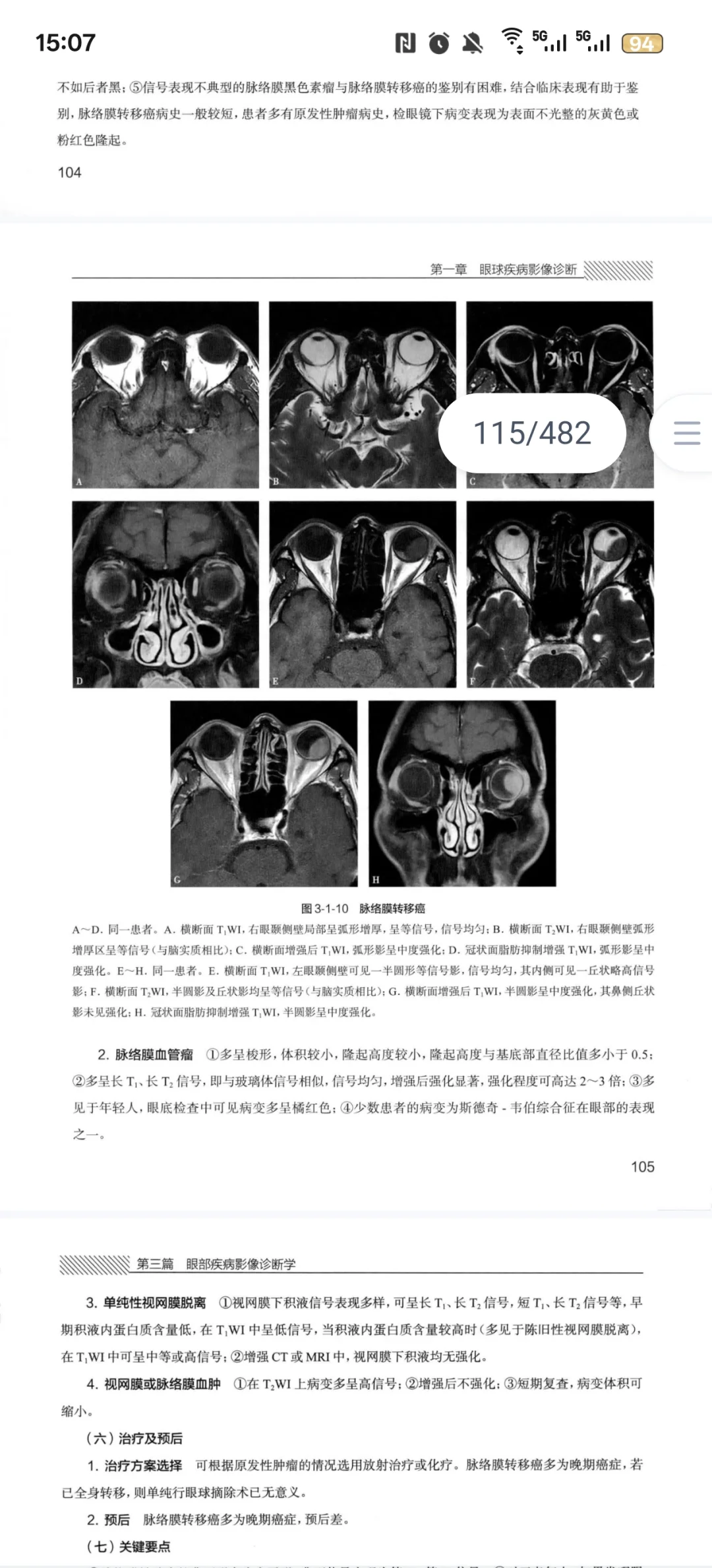 2025年7月新书推荐：眼科影像学