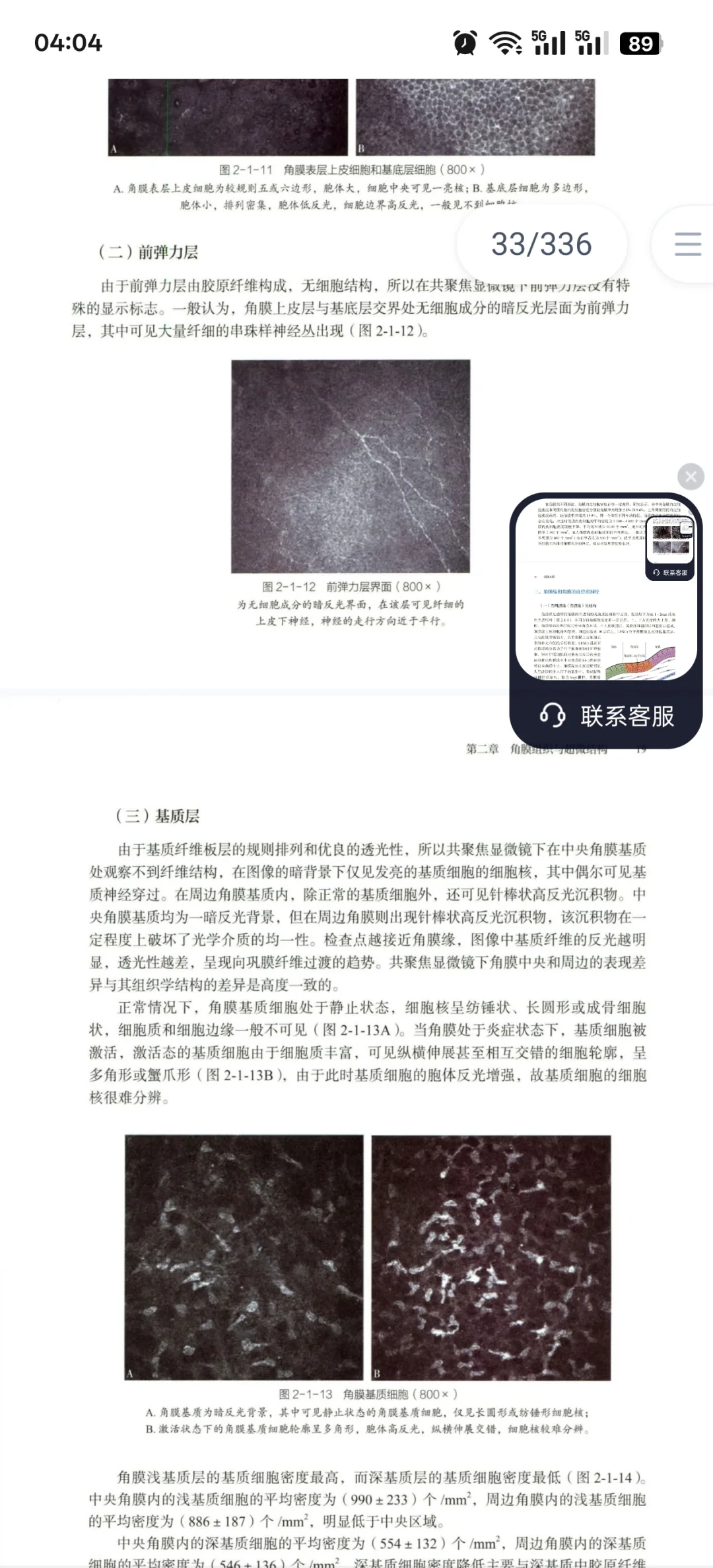 圆锥角膜必看书籍推荐