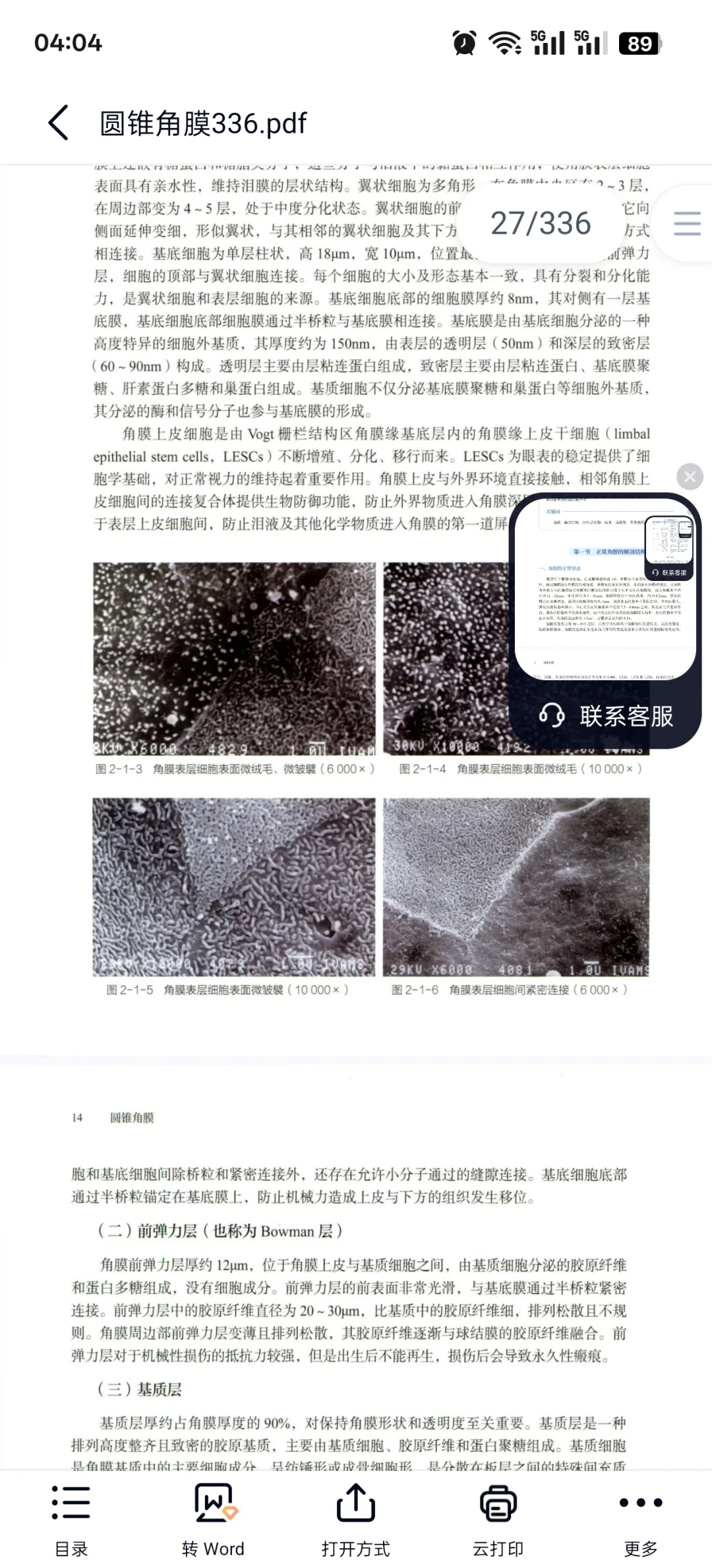 圆锥角膜必看书籍推荐