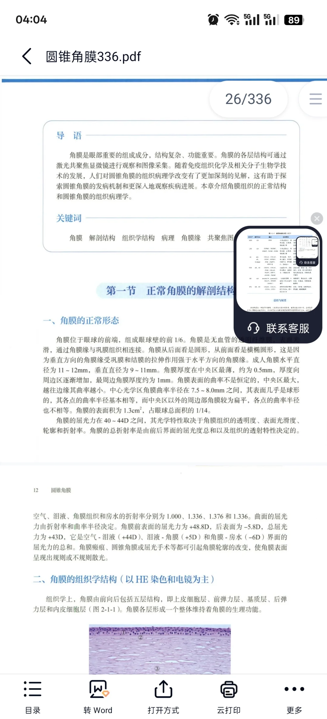 圆锥角膜必看书籍推荐
