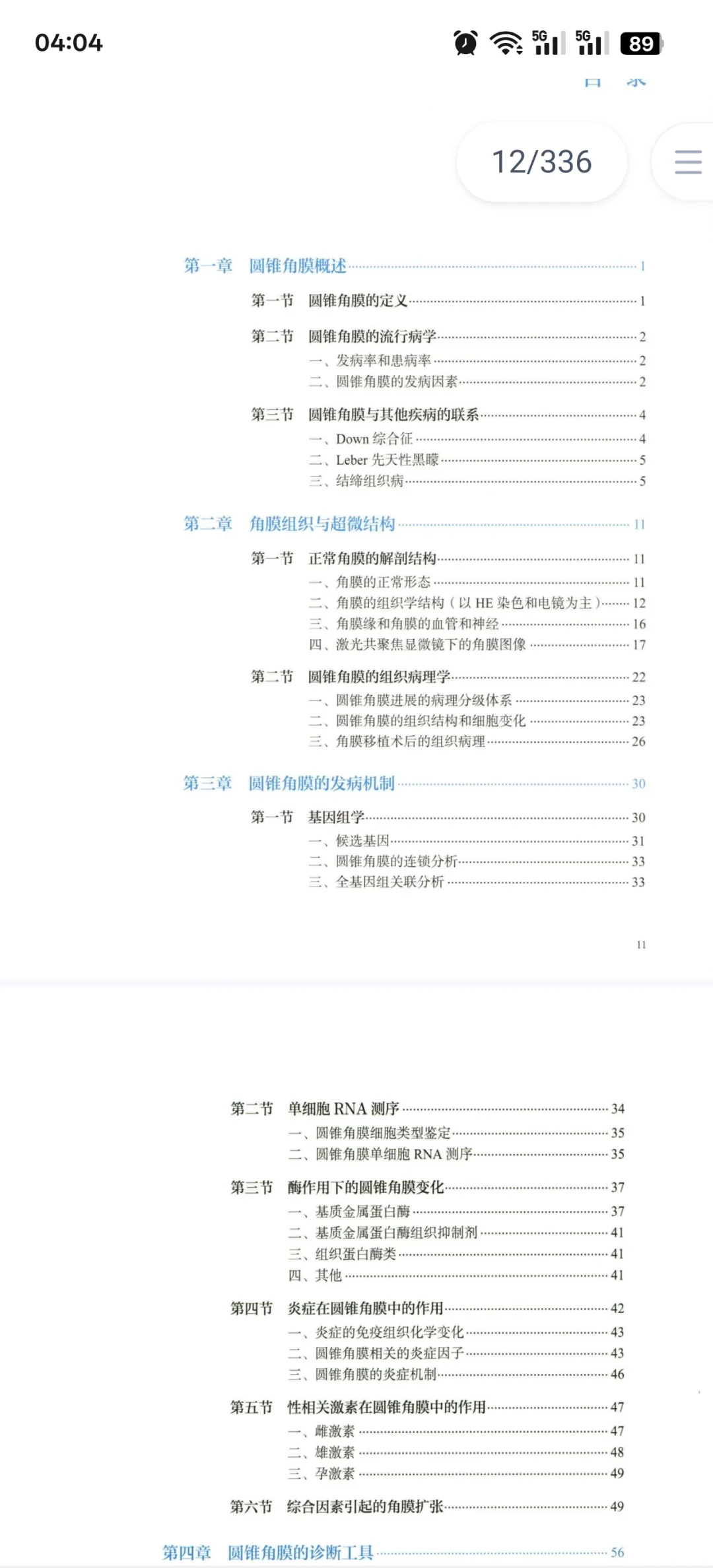 圆锥角膜必看书籍推荐