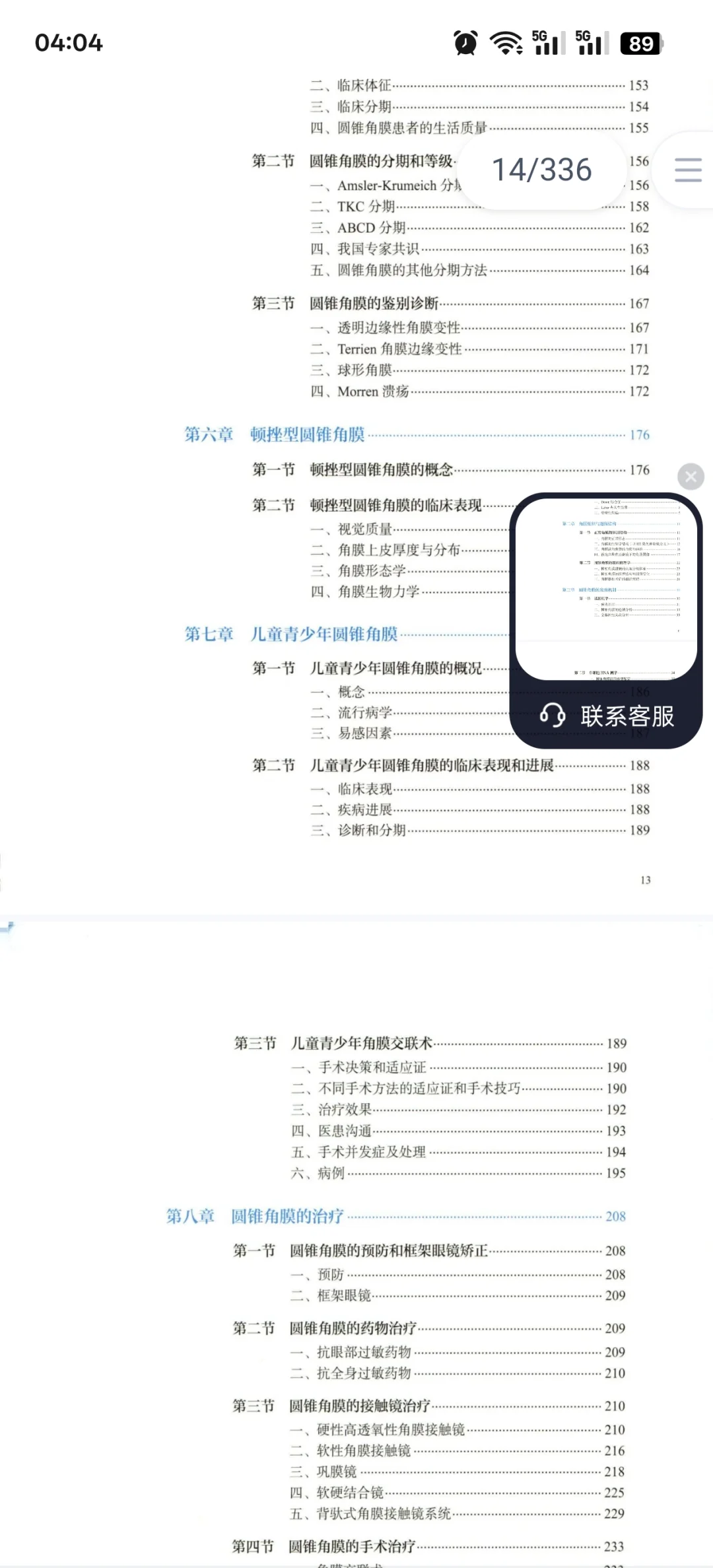 圆锥角膜必看书籍推荐