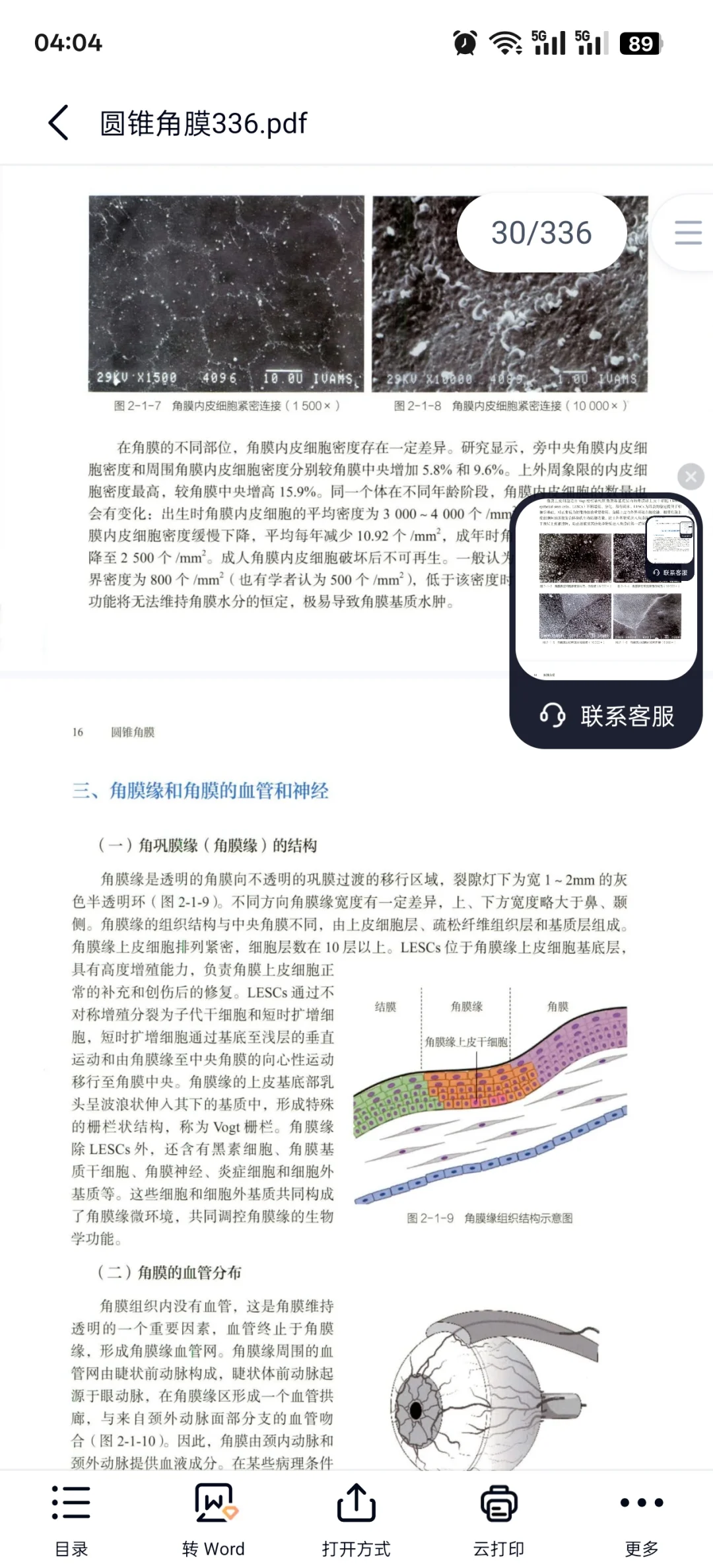 圆锥角膜必看书籍推荐
