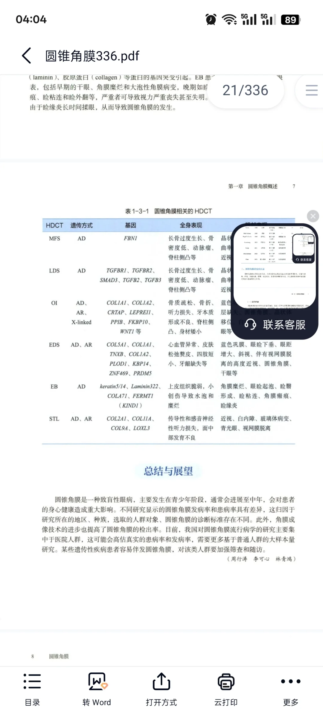 圆锥角膜必看书籍推荐