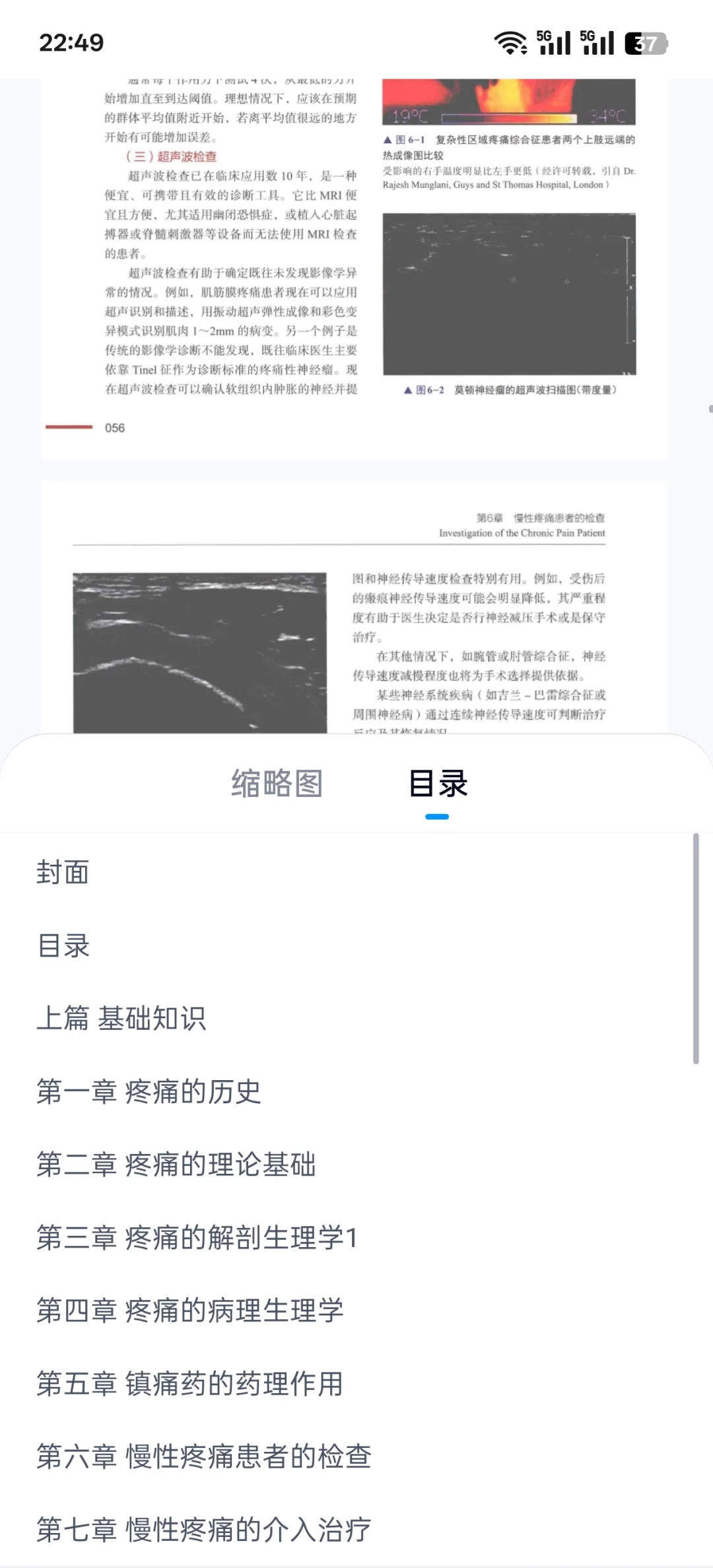 慢性疼痛管理临床实践新书推荐必看