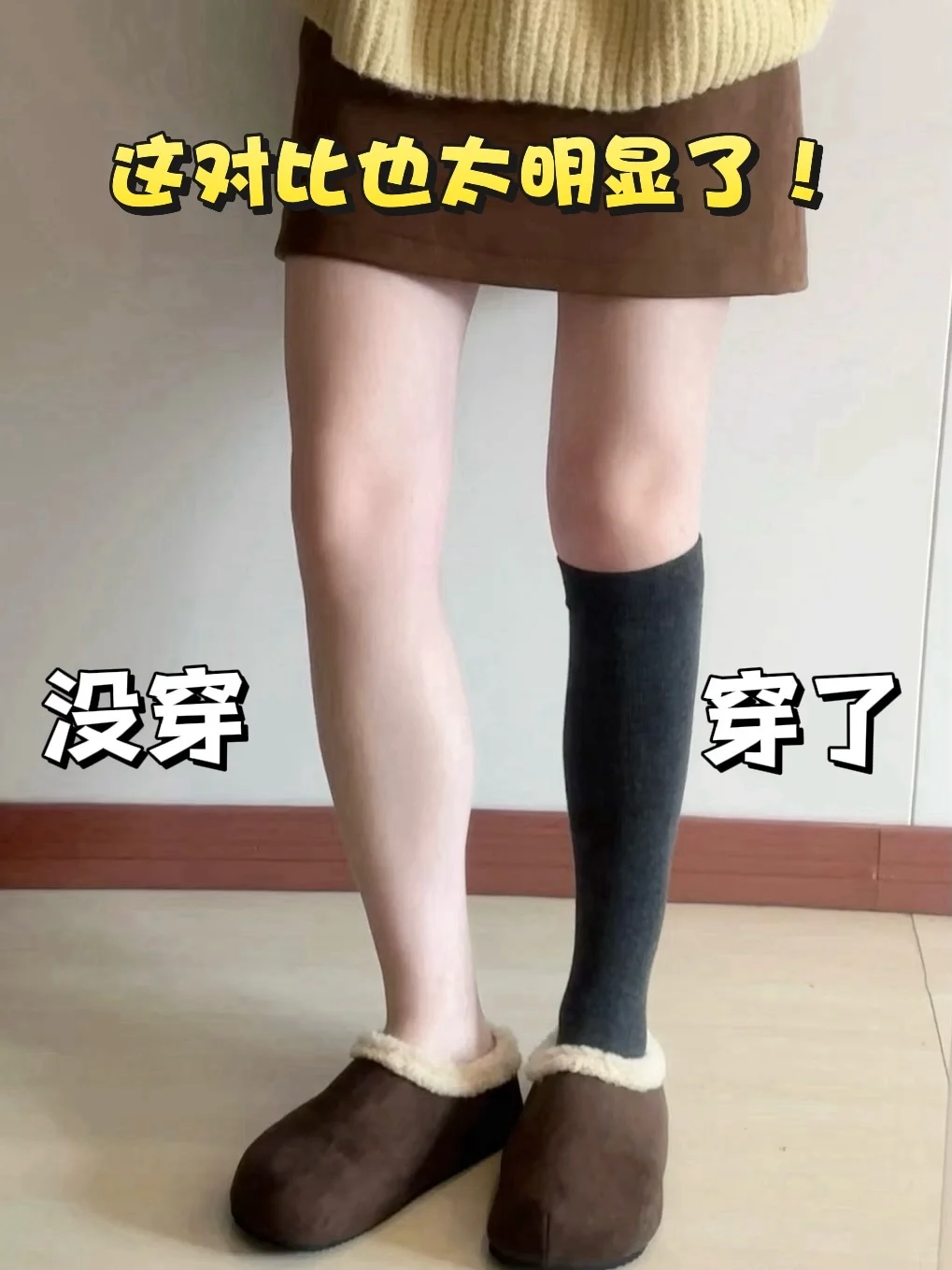 谁懂压力袜的显瘦效果！