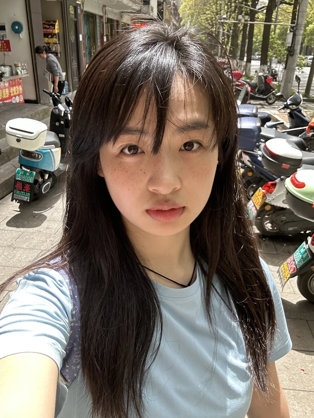 雀斑怎么一边多一边少ꪔ͈̮ ꪔ̤̫ ꪔ̤̱ ꪔ̤̥