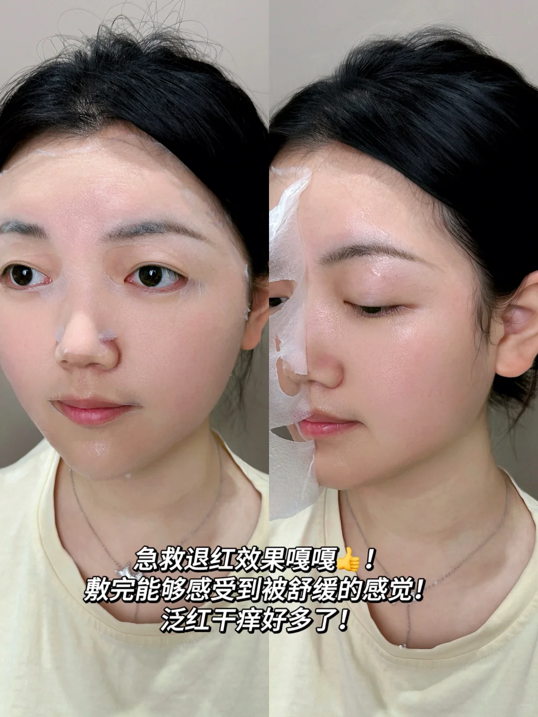 只DO脸不修护！那就是花钱受罪白玩儿！