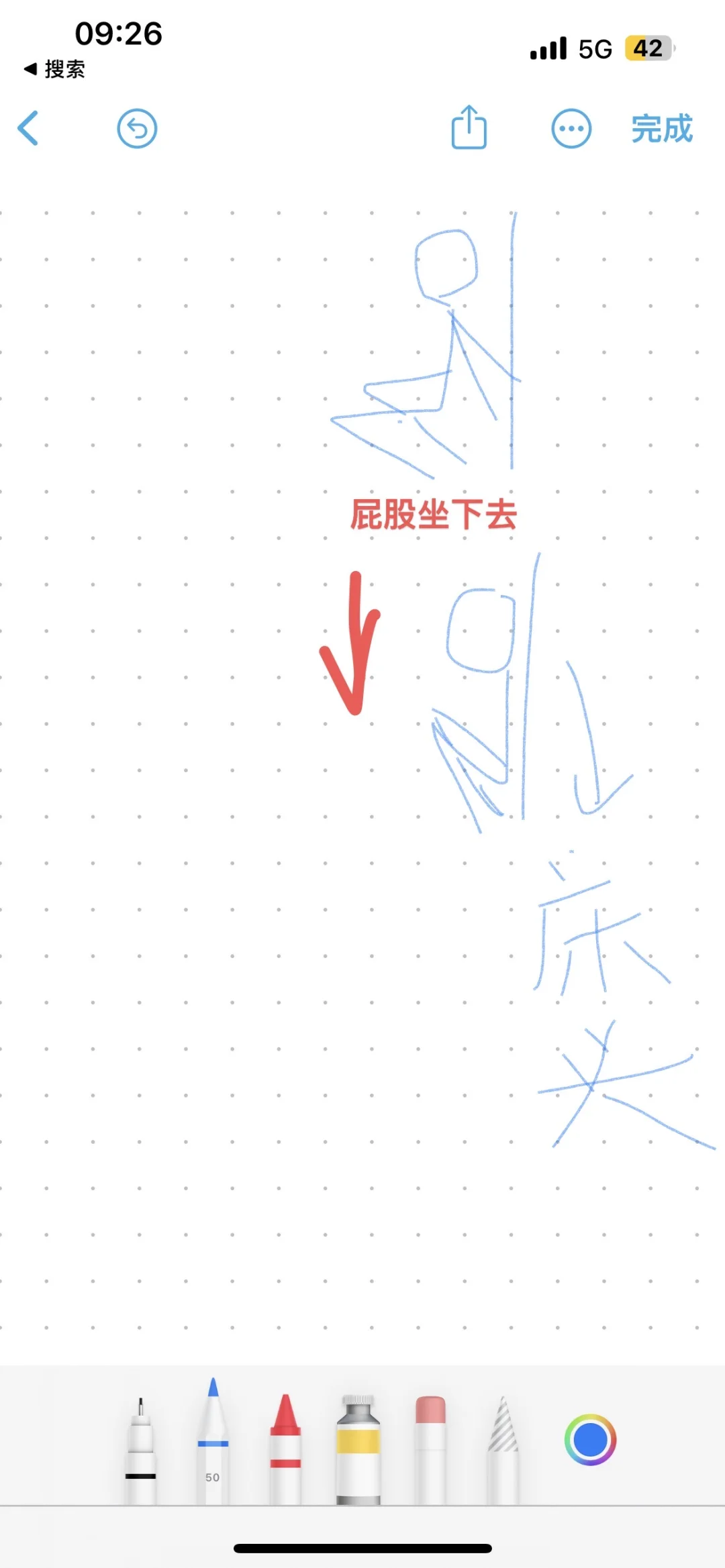 保髋截骨上下截术后第83天，穿袜子了。