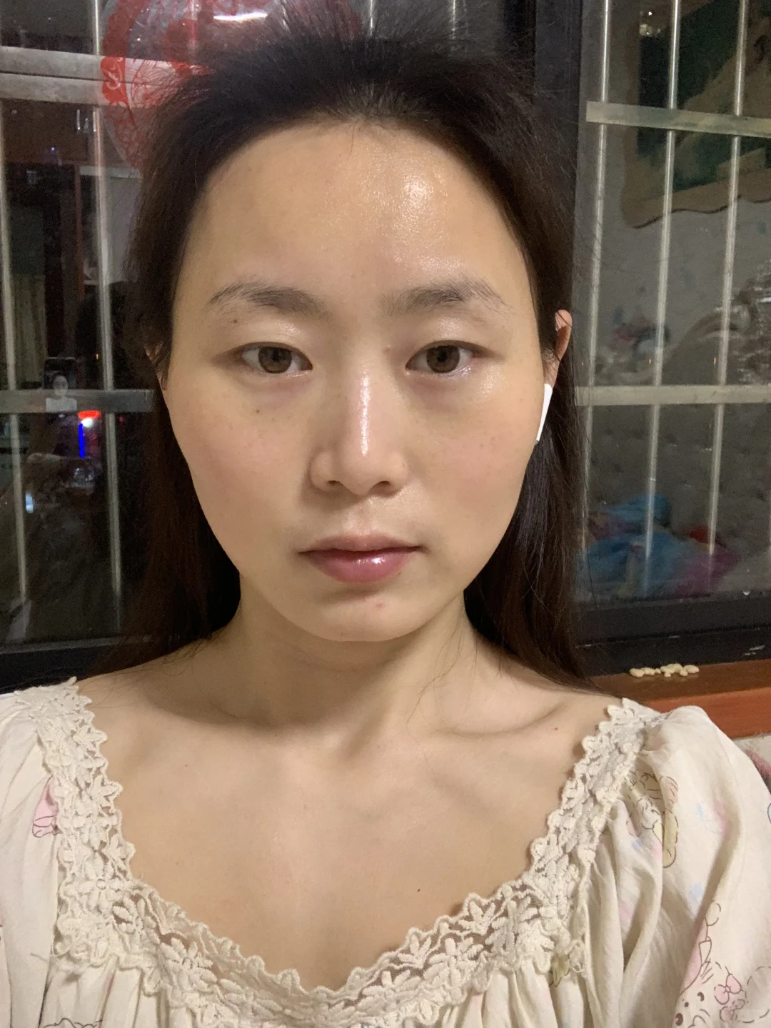 压颧骨的第一天