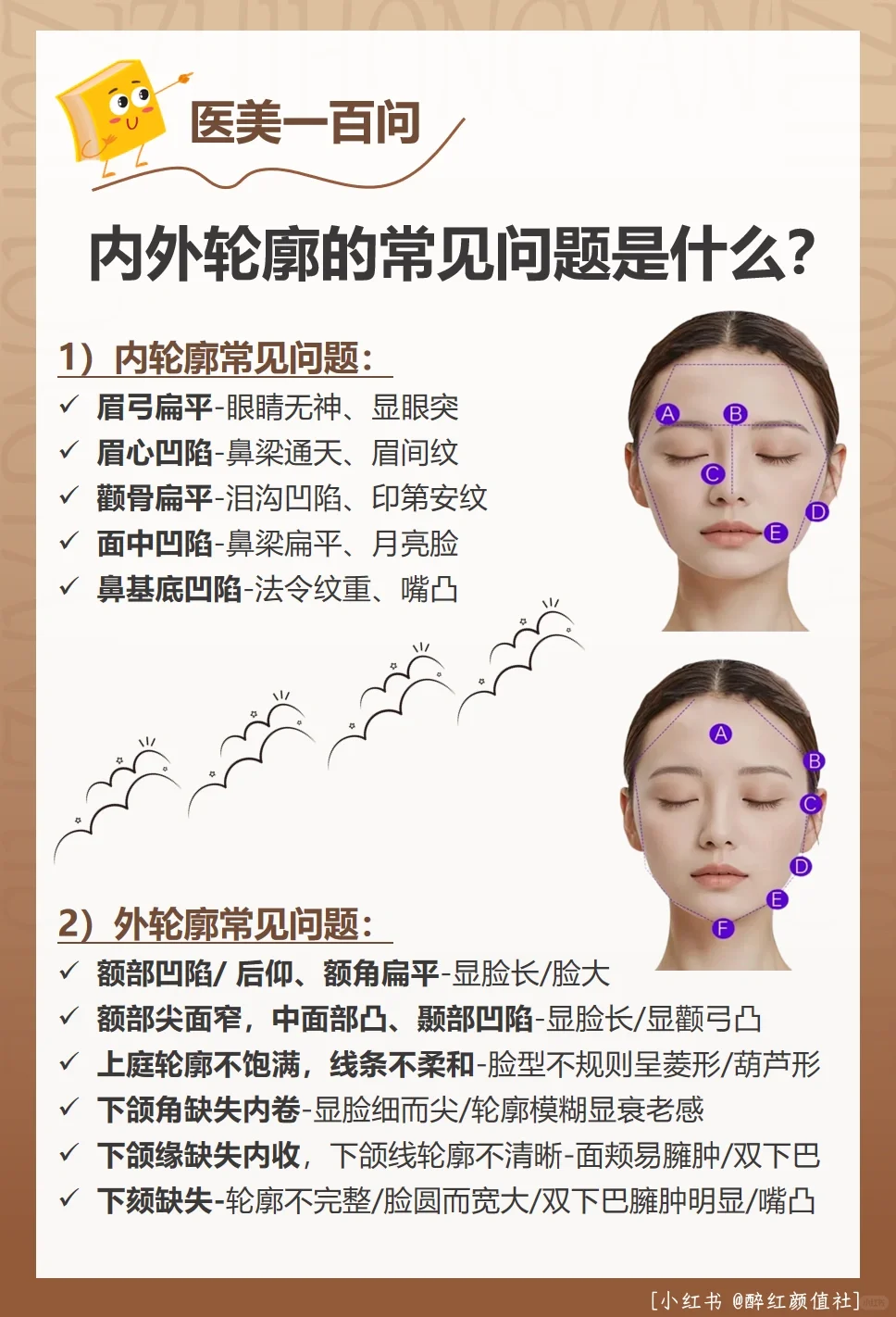 颜值100问|轮廓固定有四问（1）
