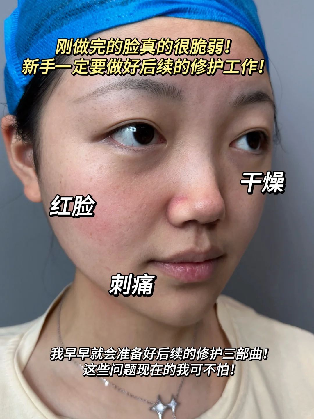 只DO脸不修护！那就是花钱受罪白玩儿！