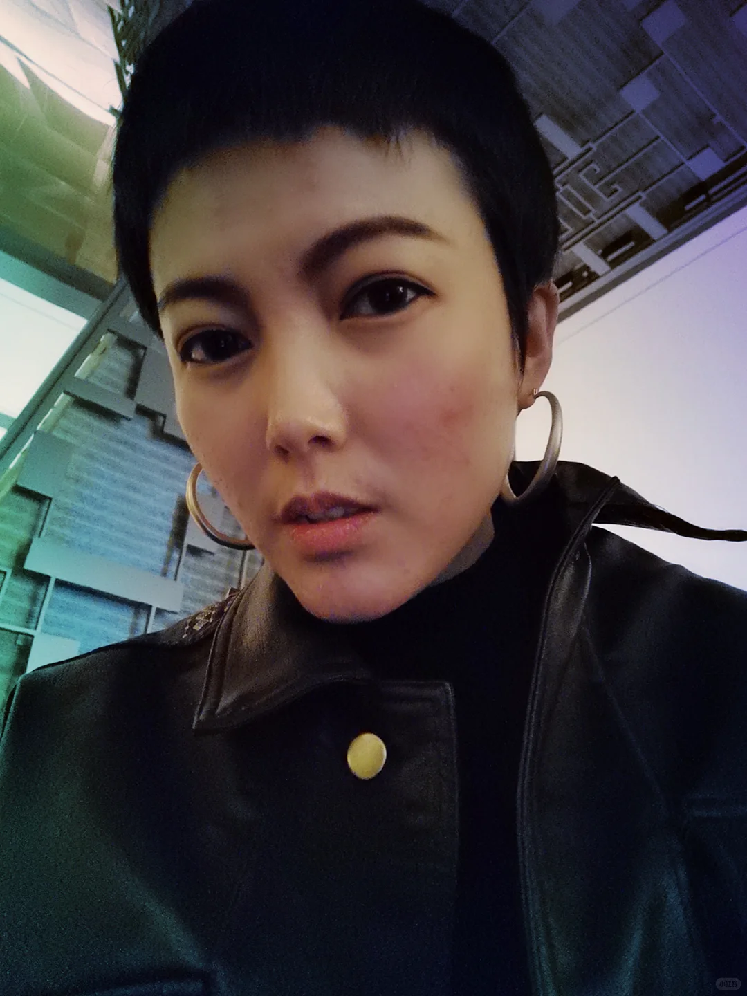 每个系统性红斑狼疮的女孩都是折翼的天使