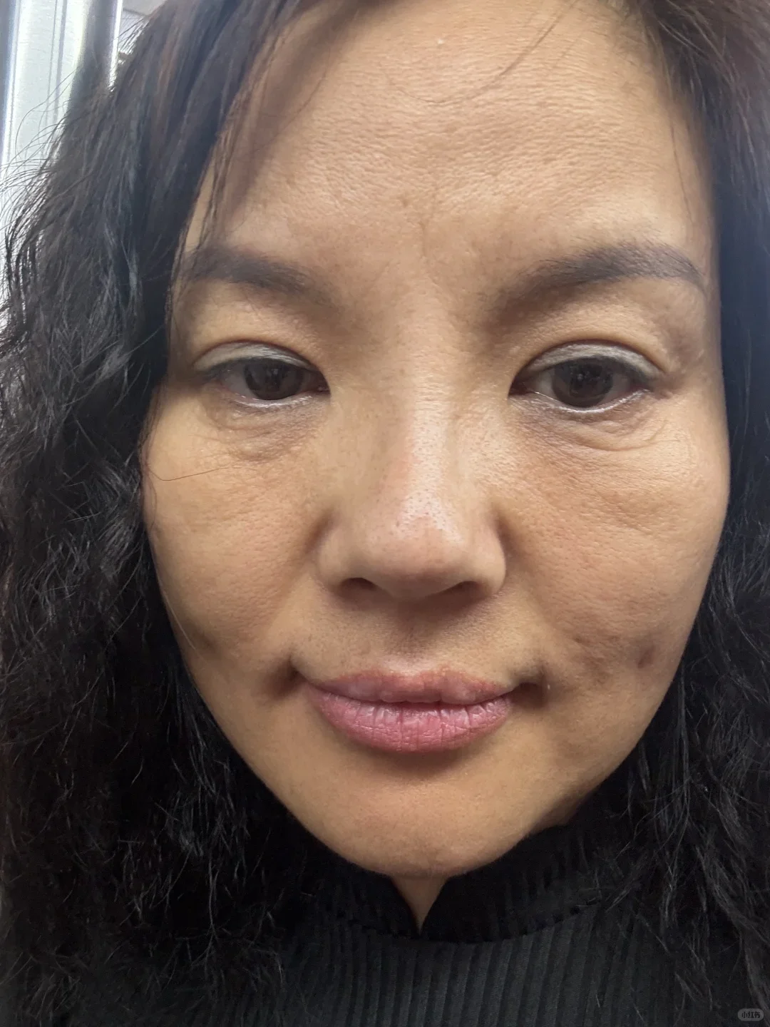 40岁才开始护肤应该不晚吧？