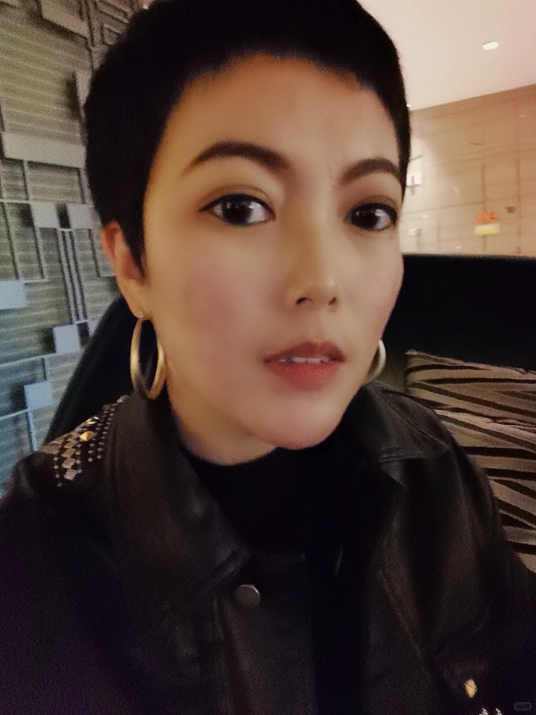 每个系统性红斑狼疮的女孩都是折翼的天使