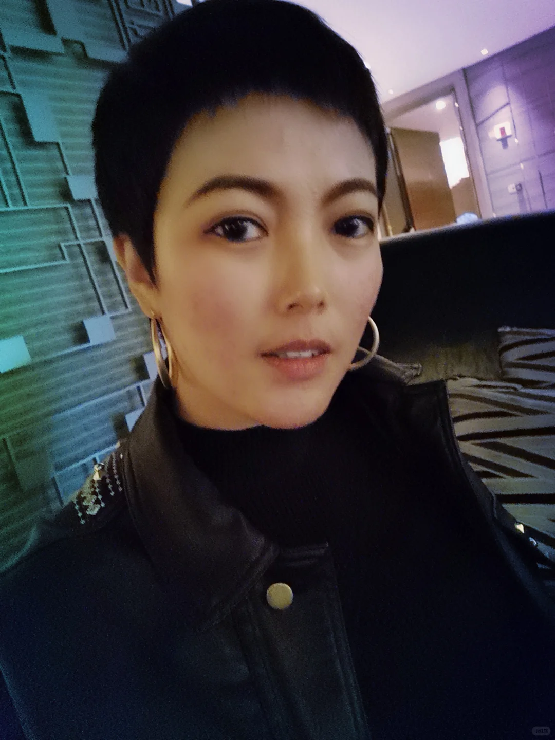 每个系统性红斑狼疮的女孩都是折翼的天使