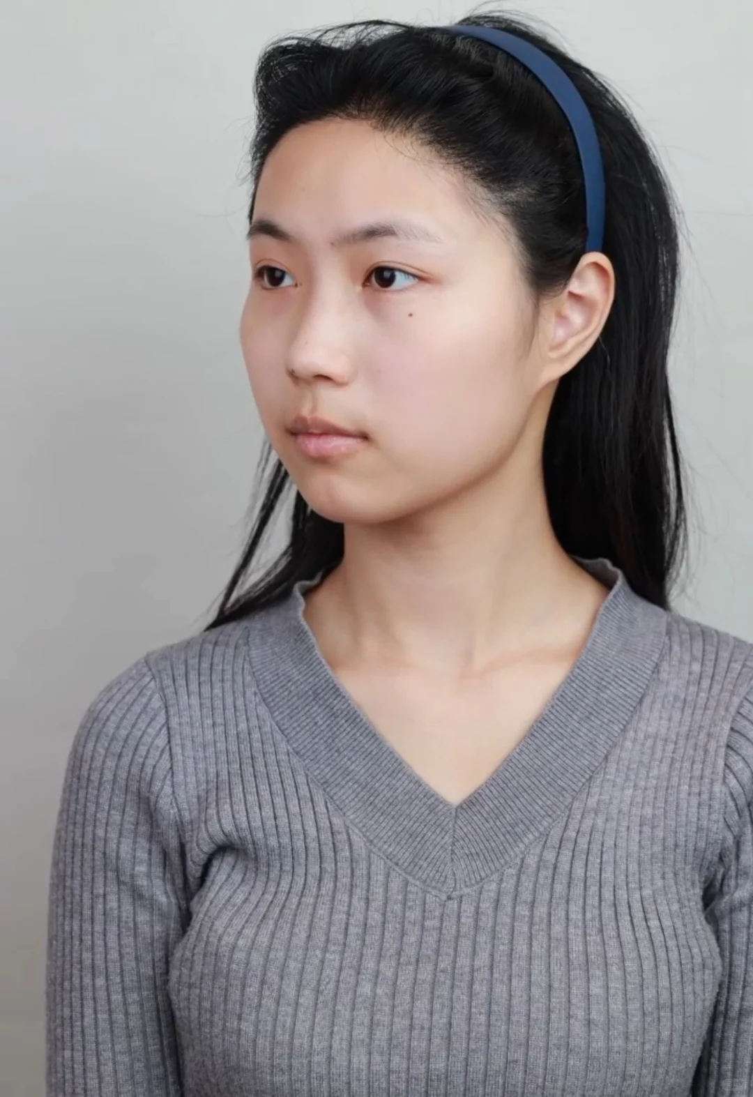 两个月前VS两个月后，得脸型者得天下😎