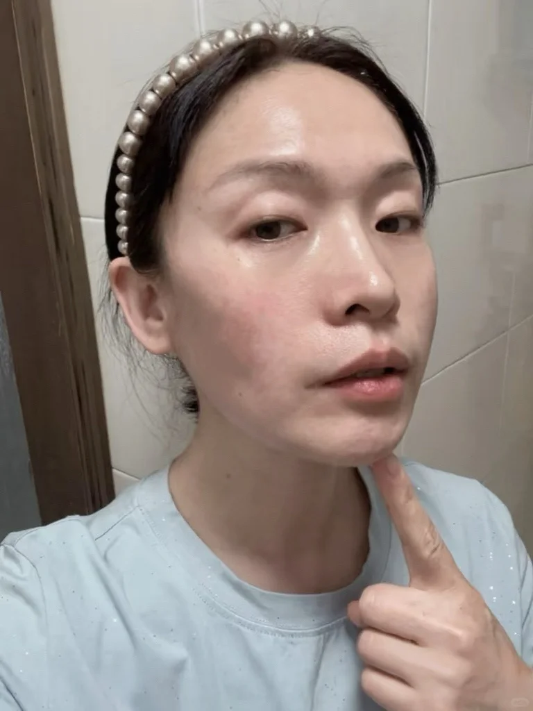 50岁阿姨垮脸之法令纹消失篇！