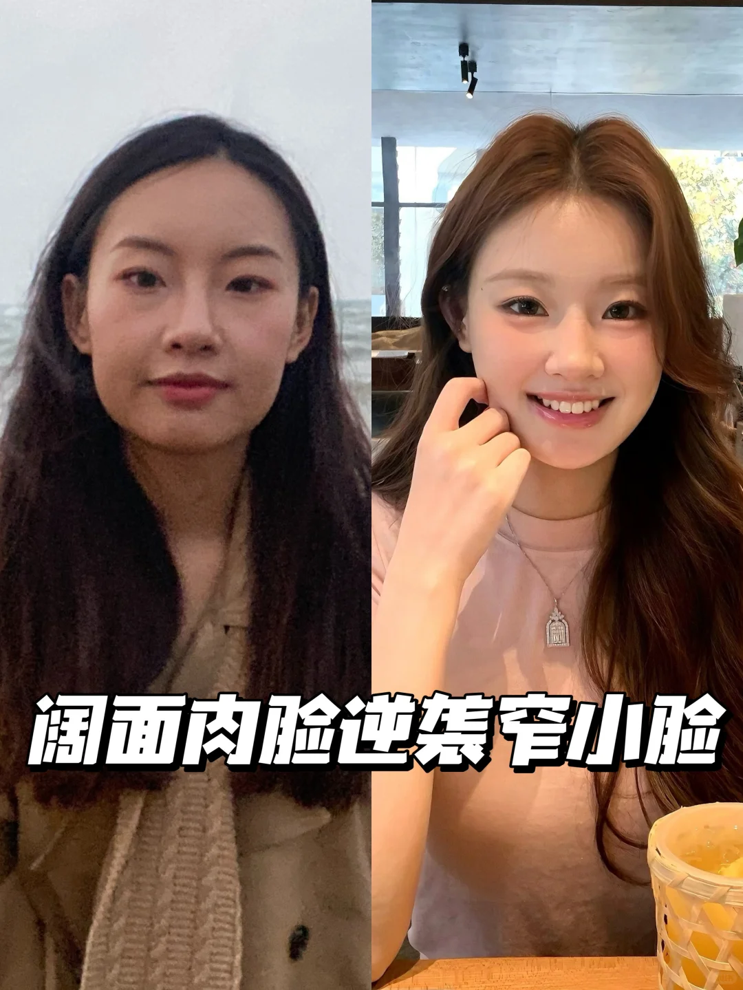 阔面肉脸变窄小脸的变美思路分享