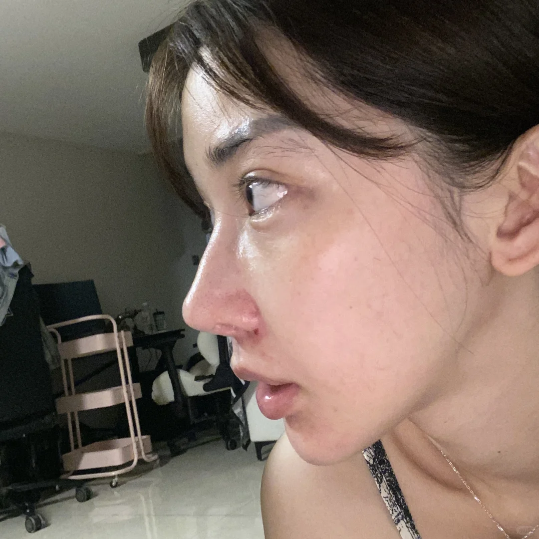 蘑菇后的皮不贴骨真的好明显