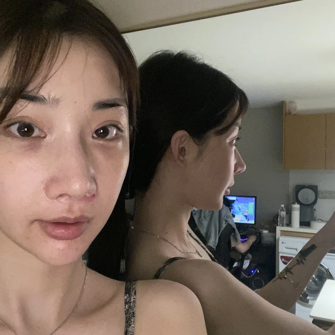 蘑菇后的皮不贴骨真的好明显