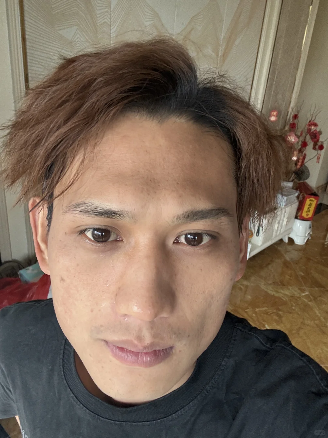 我弟祛斑美白大战的第三天❗