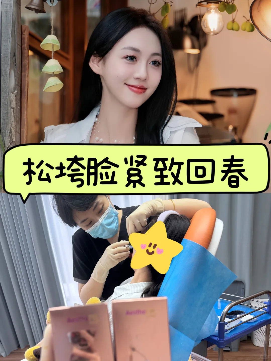 微调后脸变圆润却不肿的秘密」