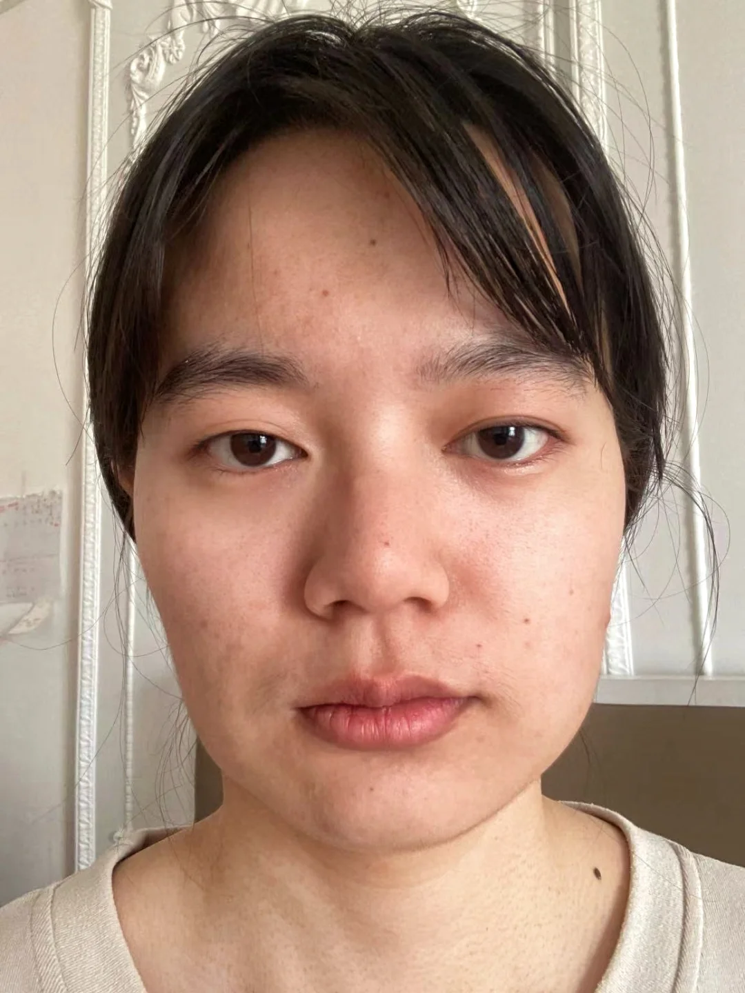 当 标准阔面脸打瘦脸针...