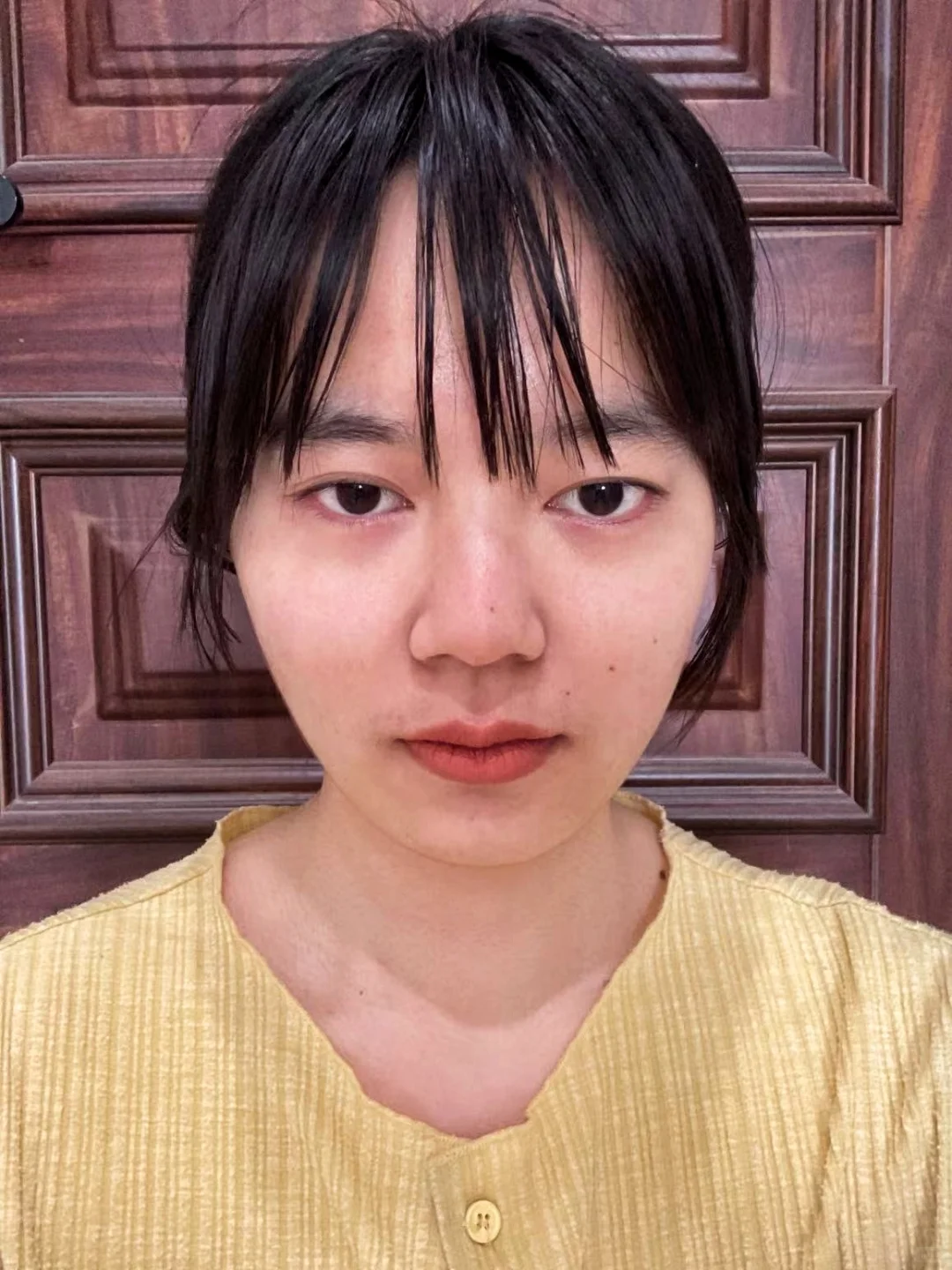 当 标准阔面脸打瘦脸针...