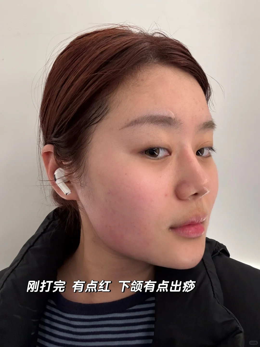 00后的超强瘦脸攻略 y美微do效率太高啦