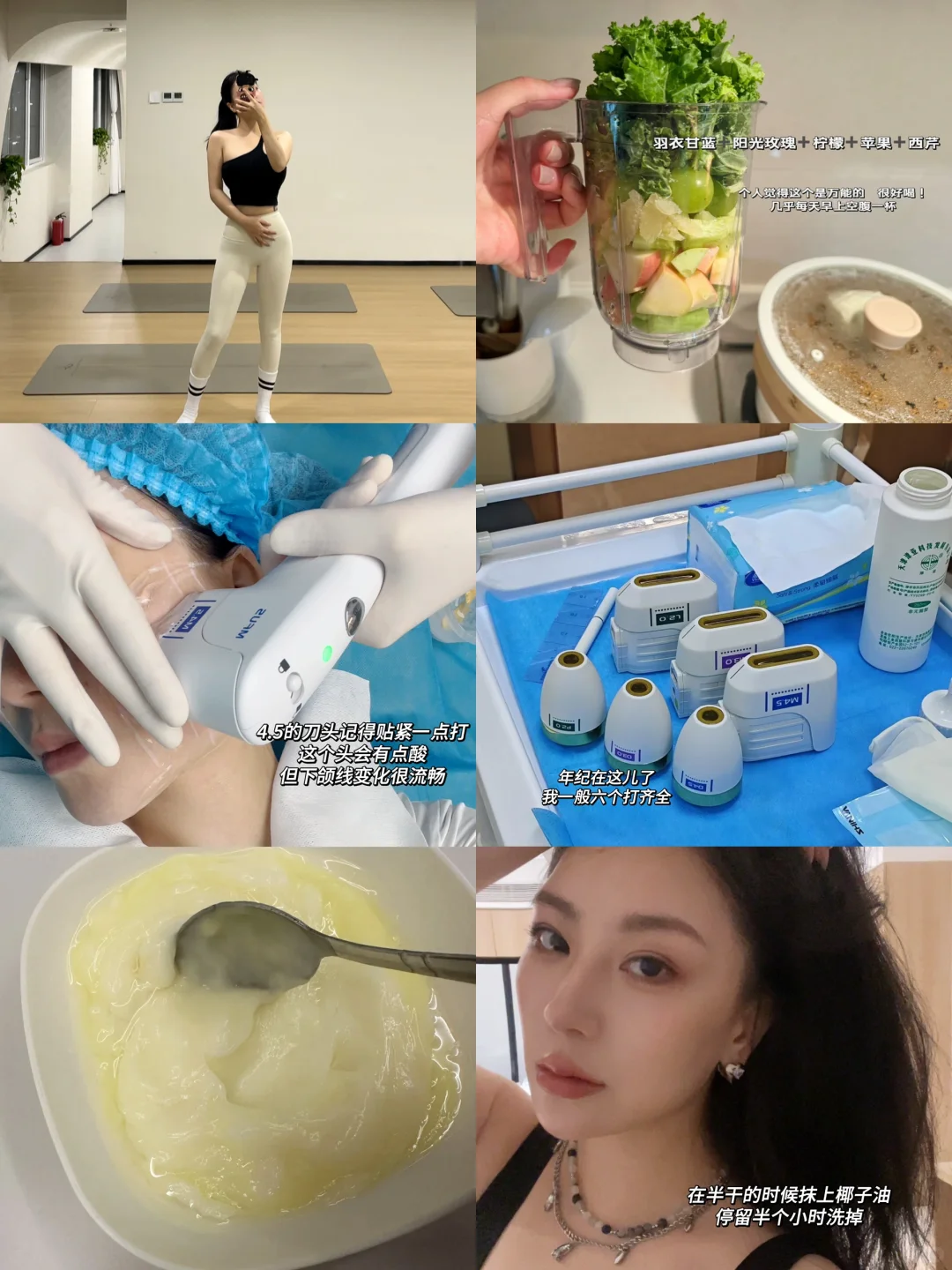 34岁维持饱满度，轻医美真的足够了！