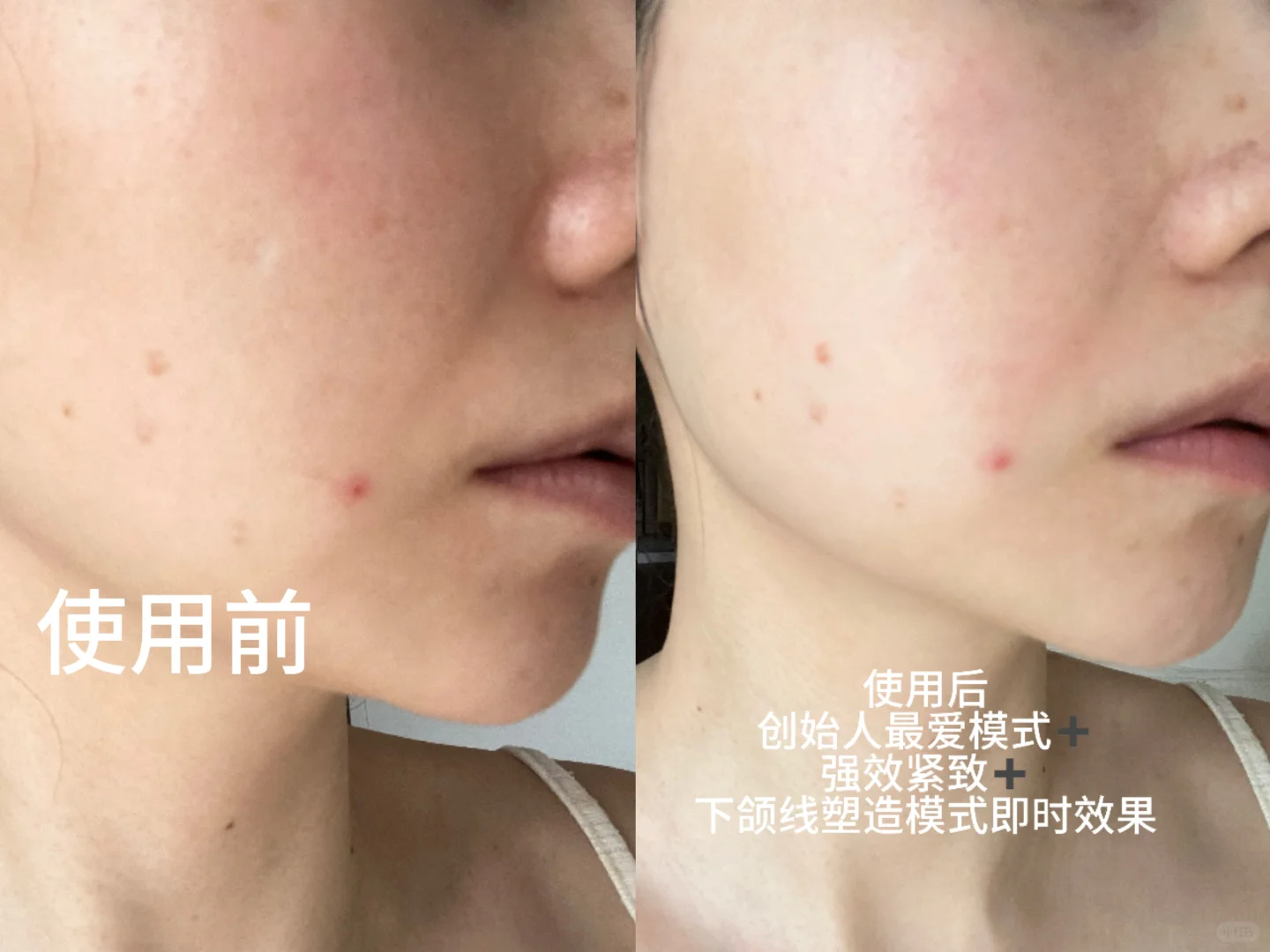 入手ZIIP美容仪 一整套护肤流程(干货版