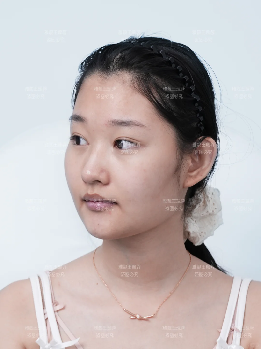 肉多+发腮+臃肿脸,变美思路来喽