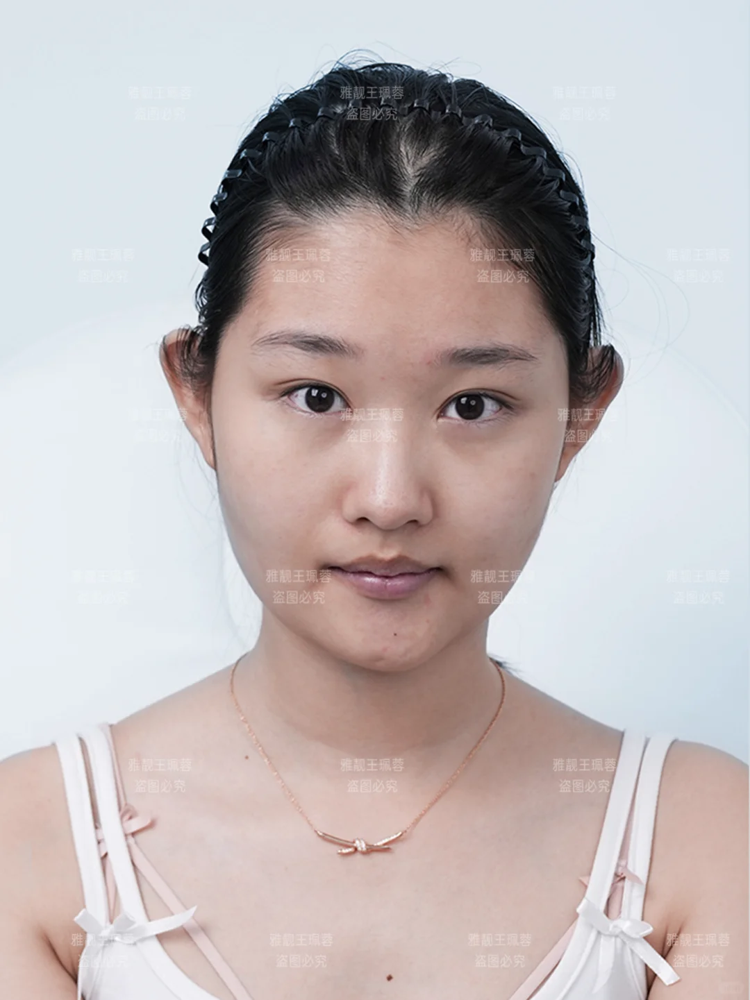 肉多+发腮+臃肿脸,变美思路来喽