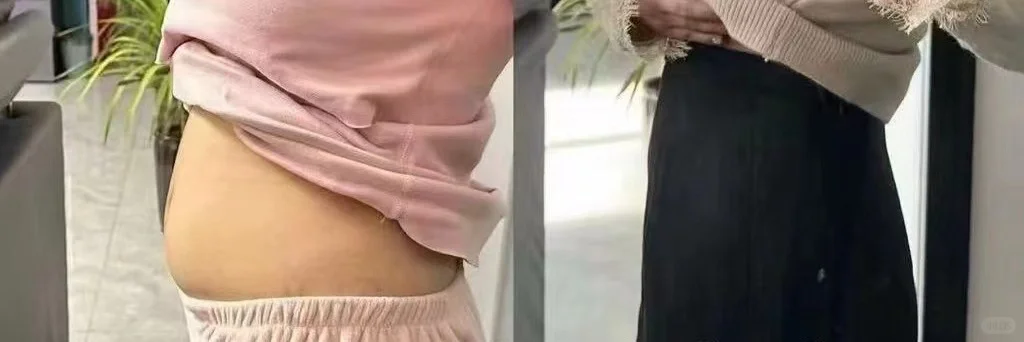 想变美+