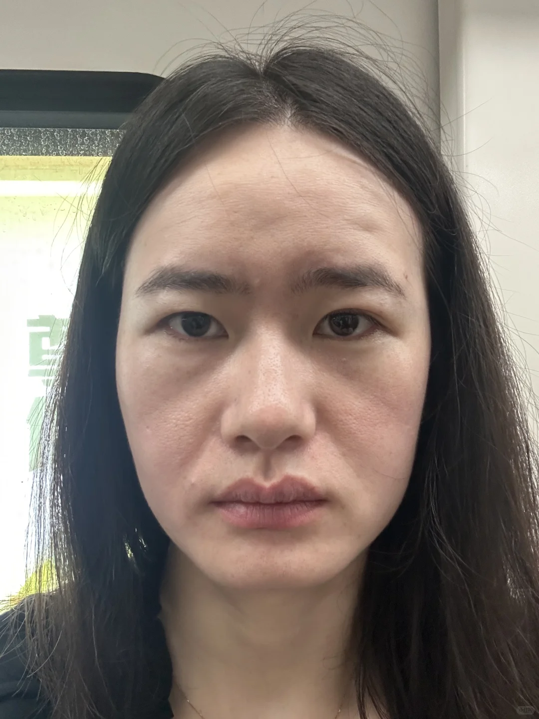 姐妹有没有好的建议我这脸要咋救啊