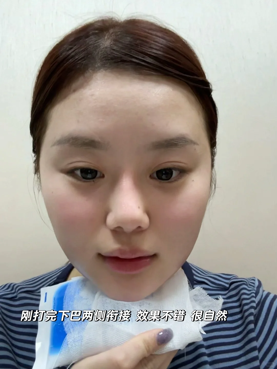 00后的超强瘦脸攻略 y美微do效率太高啦