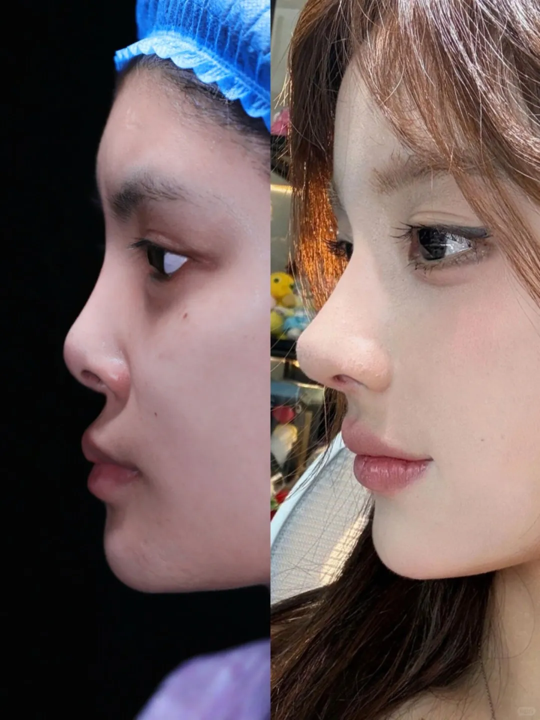 肉感圆头👃不愧是AI建模脸‼4w美晕了