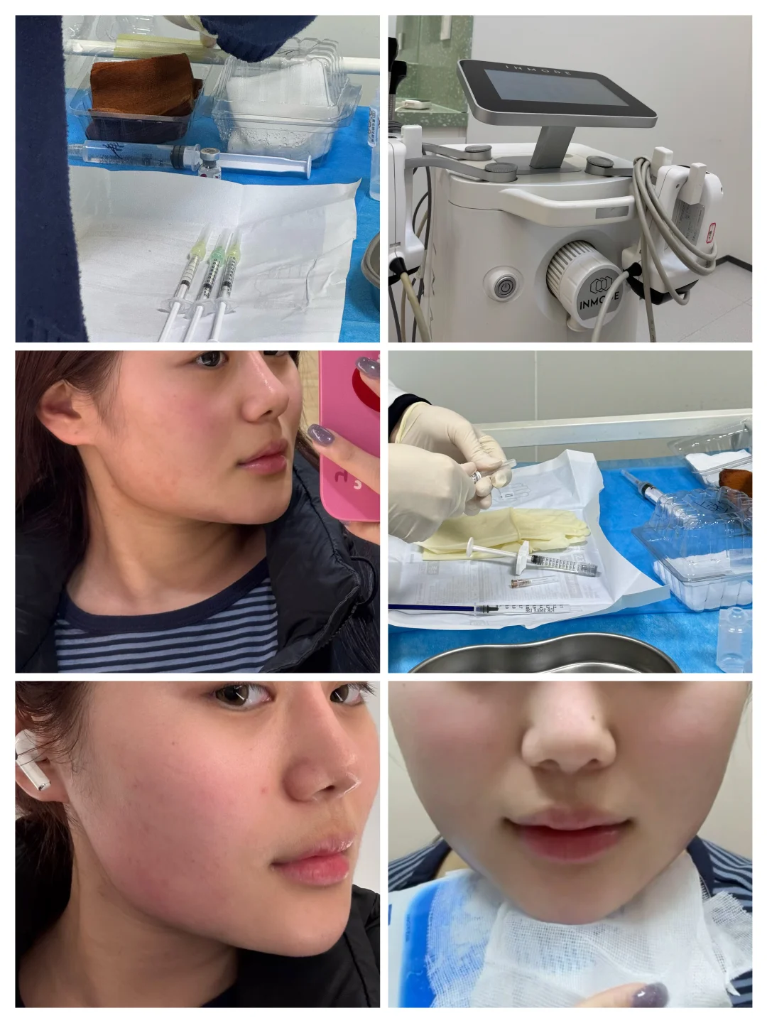 00后的超强瘦脸攻略 y美微do效率太高啦