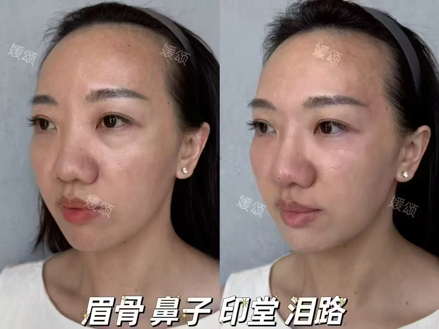 💖素颜也能美到发光！
