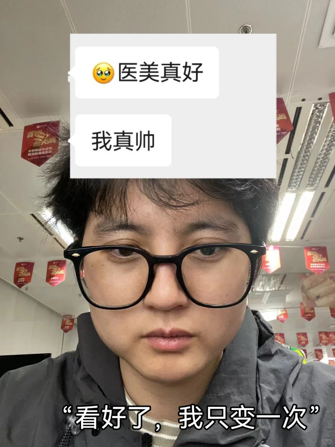 大饼脸➡️上镜脸